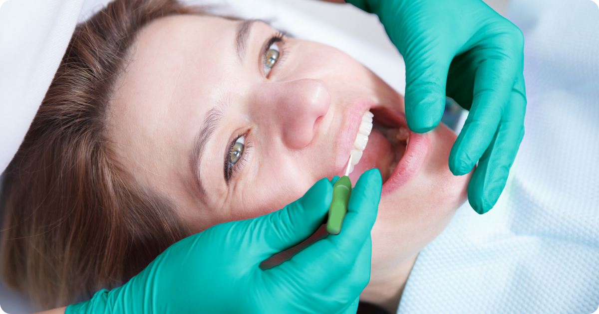 How silver diamine fluoride works: clinical evidence and practical use