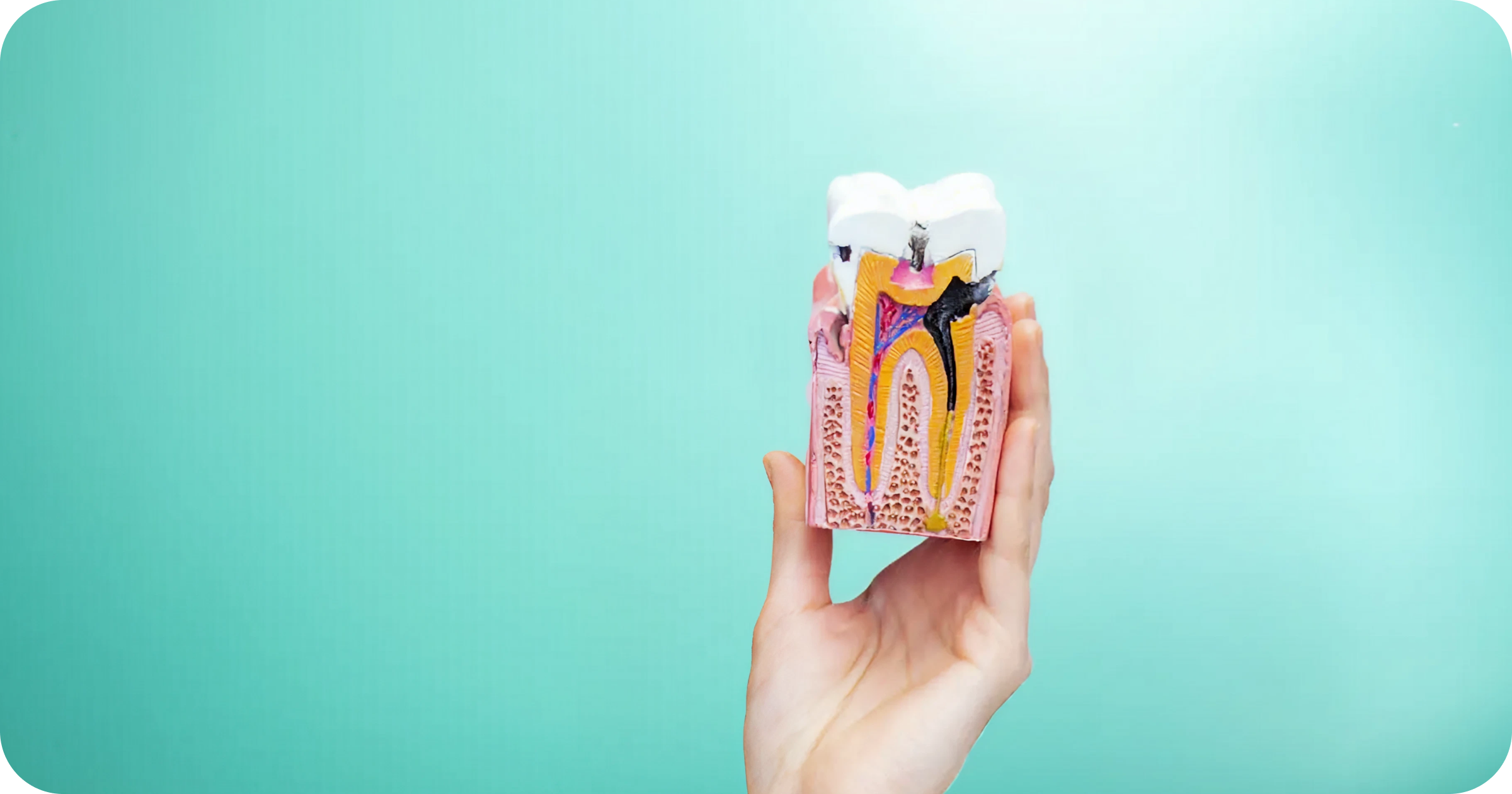SDF, Dental Sealants, or Fillings? A guide to cavity care options
